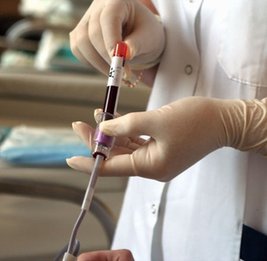 В Азербайджане начат новый проект для помощи больным с заболеваниями крови